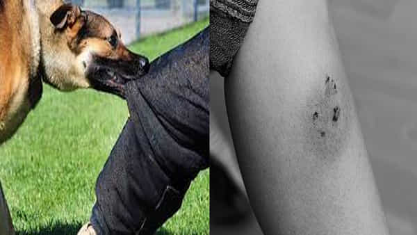 Dog Bite: కుక్క కరిస్తే నిర్లక్ష్యం వద్దు.. రక్త స్రావం వస్తే ఎటువంటి ట్రీట్మెంట్ తీసుకోవాలి.. ఎన్ని రోజులు వ్యాక్సిన్ వేస్తారో.. డీటైల్స్ మీకోసం