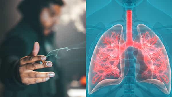 Lungs Healthy Diet: సిగరెట్టు మానలేకపోతున్నారా, అయితే ఫుడ్ తీసుకుంటే మీ లంగ్స్ ఇక భద్రం..!!