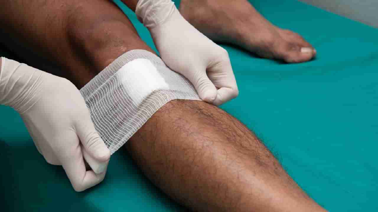 New Bacteria Infection: మీరు ఇటీవల ప్రమాదానికి గురయ్యారా? ఈ లక్షణాలు కనిపిస్తే ప్లీజ్ అలర్ట్.. లేకపోతే ప్రాణపాయమే..!