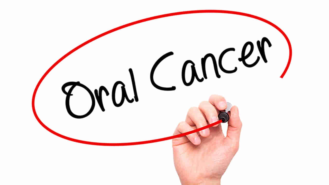 Oral Cancer: మీలో ఈ లక్షణాలు కనిపిస్తున్నాయా..? అయితే జాగ్రత్త.. నిర్లక్ష్యం చేస్తే నోటి క్యాన్సర్ కాగలదు..