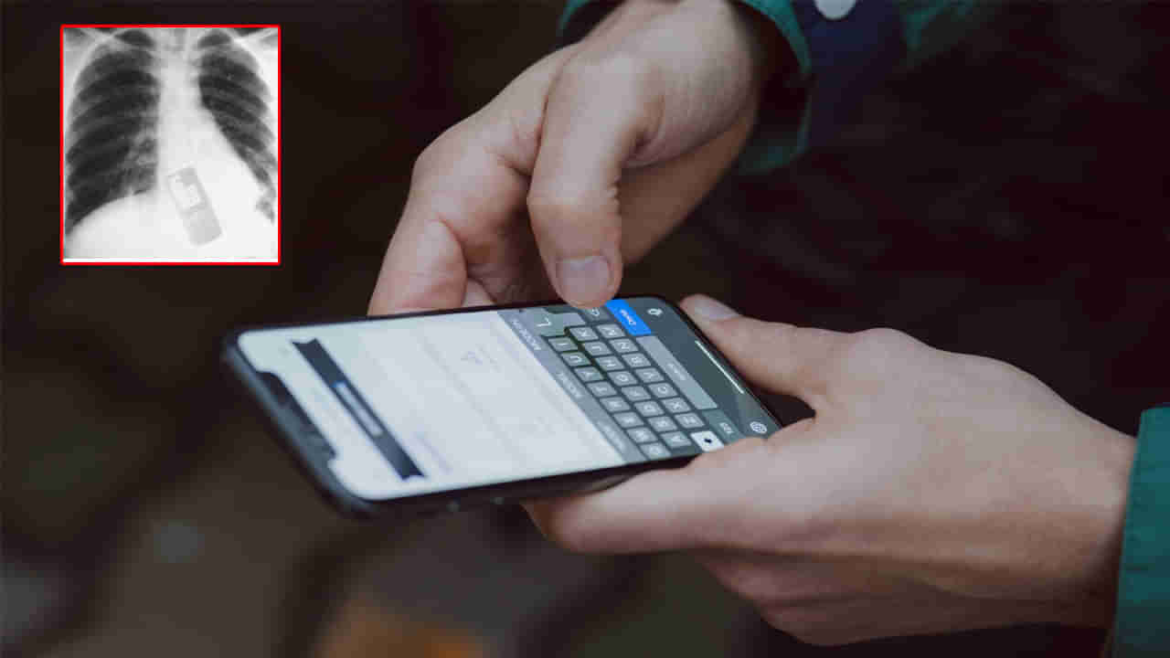 Mobile Phone: జైల్లో ఆకస్మిక తనిఖీలు.. భయంతో మొబైల్‌ ఫోన్‌ మింగేసిన ఖైదీ..