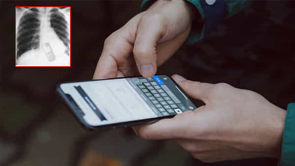 Mobile Phone: జైల్లో ఆకస్మిక తనిఖీలు.. భయంతో మొబైల్ ఫోన్ మింగేసిన ఖైదీ..