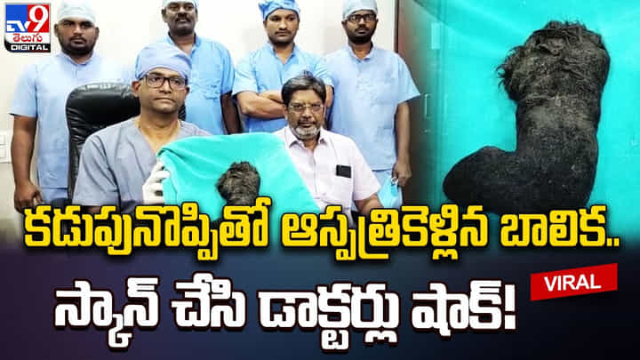 కడుపునొప్పితో ఆస్పత్రికెళ్లిన బాలిక.. స్కాన్ చేసి డాక్టర్లు షాక్ !! కడుపునొప్పితో ఆస్పత్రికెళ్లిన బాలిక.. స్కాన్ చేసి డాక్టర్లు షాక్ !!