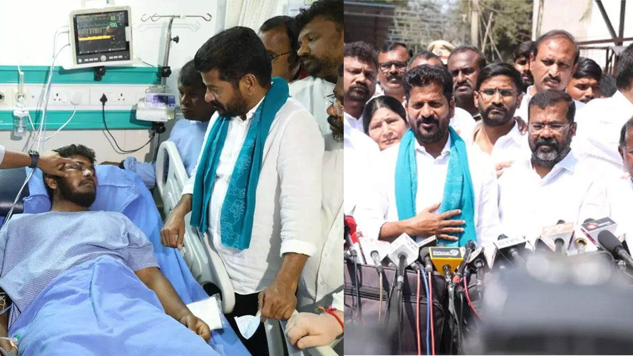 Revanth Reddy: వరంగల్ యూత్ లీడర్‌ను పరామర్శించిన రేవంత్ రెడ్డి.. బీఆర్ఎస్ నేతలపై ఫైర్.. దిష్టి బొమ్మలను దహనం చేయాలంటూ..