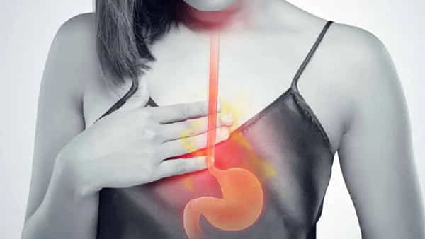 Acid Reflux: యాసిడ్ రిఫ్లక్స్తో బాధపడుతున్నారా? ఈ ఆహారాలు అస్సలు తినకండి..