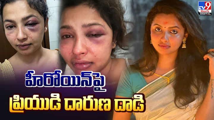 హీరోయిన్పై ప్రియుడి దాడి.. దారుణంగా హింసించాడు అంటూ వెల్లడి హీరోయిన్పై ప్రియుడి దాడి.. దారుణంగా హింసించాడు అంటూ వెల్లడి
