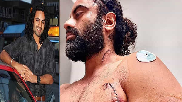 ప్రముఖ నటుడిపై గుర్తు తెలియని వ్యక్తి కత్తితో దాడి.. వీడియో వైరల్
