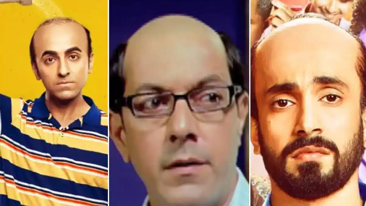 Baldness Telugu News 