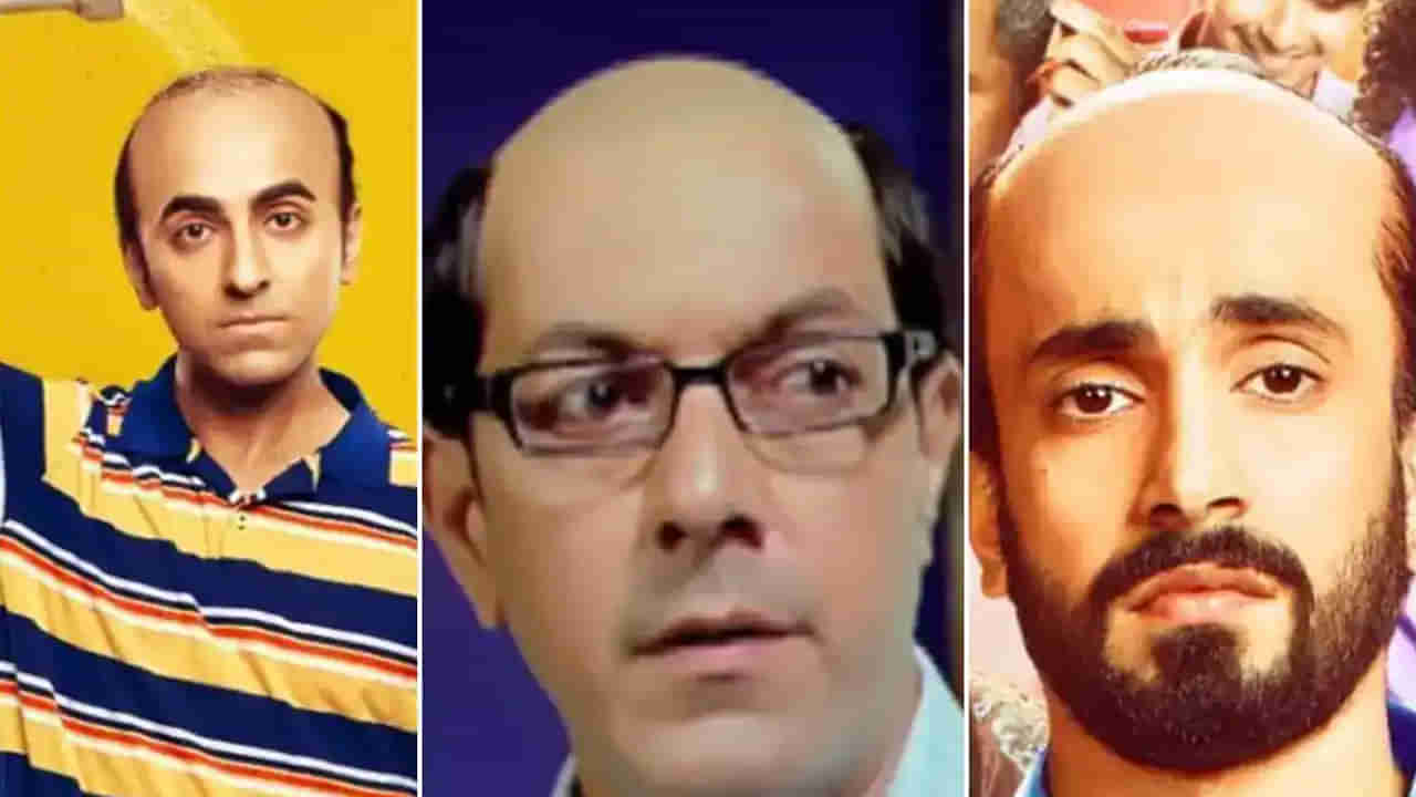 Baldness: మగవారికే బట్టతల ఎందుకు వస్తుంది...? ఆడవారికి ఎందుకు రాదు.. రీజన్ ఇదే