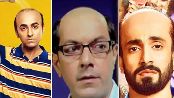 Baldness: మగవారికే బట్టతల ఎందుకు వస్తుంది...? ఆడవారికి ఎందుకు రాదు.. రీజన్ ఇదే