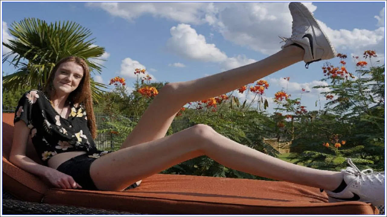 Girl With Longest Legs: ప్రపంచంలోనే అత్యంత పొడవాటి కాళ్లు ఉన్న అమ్మాయి.. గిన్నిస్ వరల్డ్ రికార్డ్‌లో నమోదు