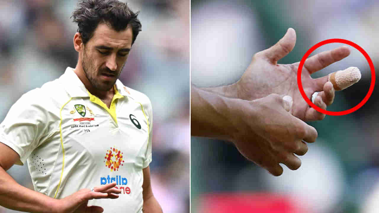 Mitchell Starc: కమిట్మెంట్‌ అంటే ఇదేనేెమో..! రక్తం కారుతున్నా బౌలింగ్‌ చేసిన మిచెల్‌ స్టార్క్‌.. వైరల్ అవుతున్న వీడియో..