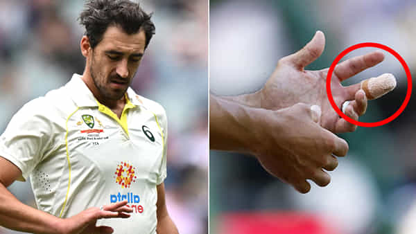 Mitchell Starc: కమిట్మెంట్ అంటే ఇదేనేెమో..! రక్తం కారుతున్నా బౌలింగ్ చేసిన మిచెల్ స్టార్క్.. వైరల్ అవుతున్న వీడియో..