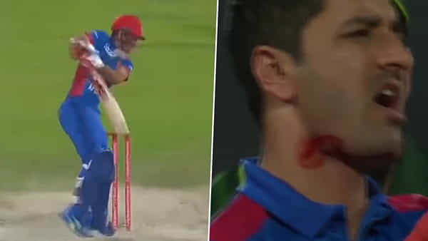 AFG vs PAK: బుల్లెట్లా దూసుకొచ్చిన రాకాసి బౌన్సర్.. దెబ్బకు ధారలా కారిన రక్తం.. వీడియో వైరల్