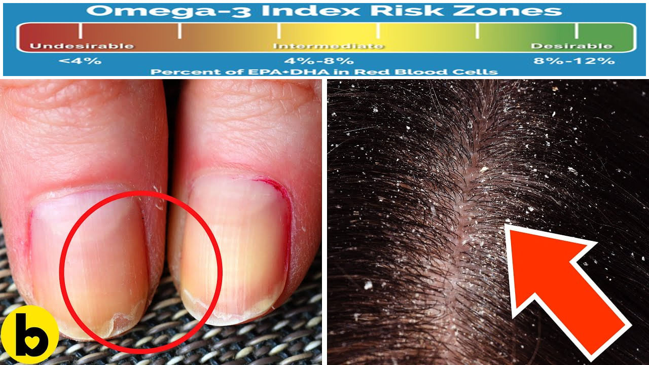 Omega 3 Fatty Acid మీలో కూడా ఈ లక్షణాలు కనిపిస్తున్నాయి.. అయితే వెంటనే