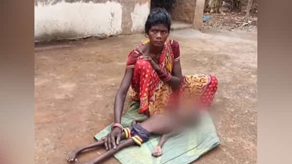 Malnutrition: అయ్యో దేవుడా.. పోషకాహార లోపంతో చిన్నారి మృతి.. మరికొంతమంది పరిస్థితి విషమం..