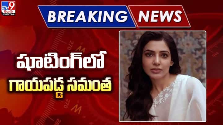 Samantha: షూటింగ్లో గాయపడ్డ సమంత !! నెట్టింట వైరల్ Samantha: షూటింగ్లో గాయపడ్డ సమంత !! నెట్టింట వైరల్