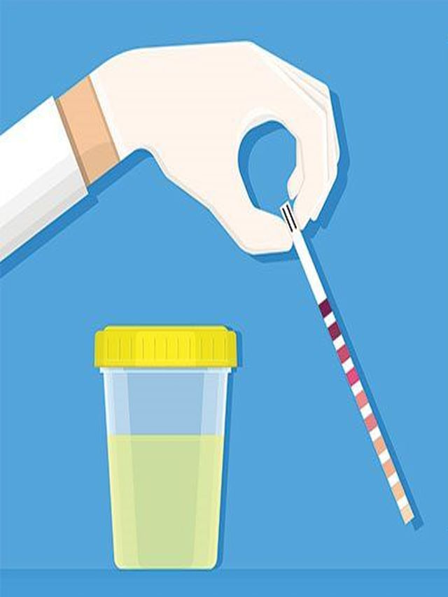 Urine 4