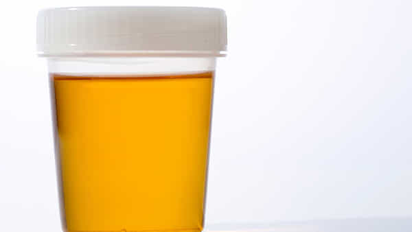 Urine Infection: మూత్రం రంగు మారి... వాసన వస్తుందా అయితే మీ పని గోవిందా..?