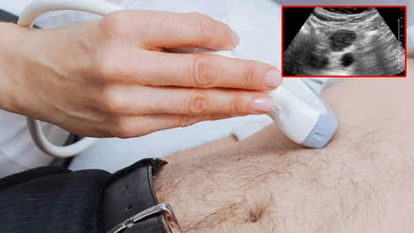 Viral News: కడుపు నొప్పితో హాస్పిటల్ వెళ్లిన యువకుడు.. స్కానింగ్ చేసి చూడగా ఉలిక్కిపడ్డ వైద్యులు.