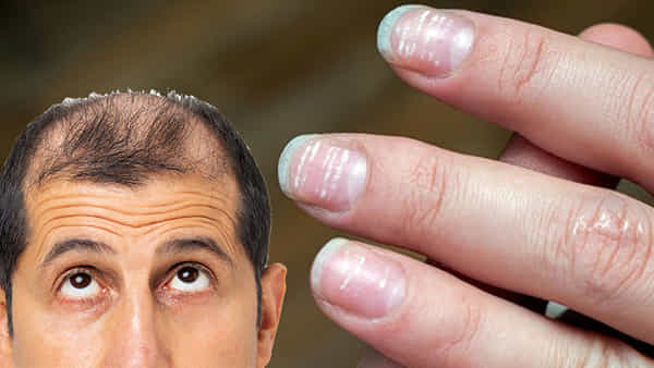 Zinc Deficiency: శరీరంలో జింక్ లోపం లక్షణాలివే.. కనిపిస్తే వెంటనే ఈ ఆహారాలను తినడం ప్రారంభించండి.. లేకపోతే అంతే..!