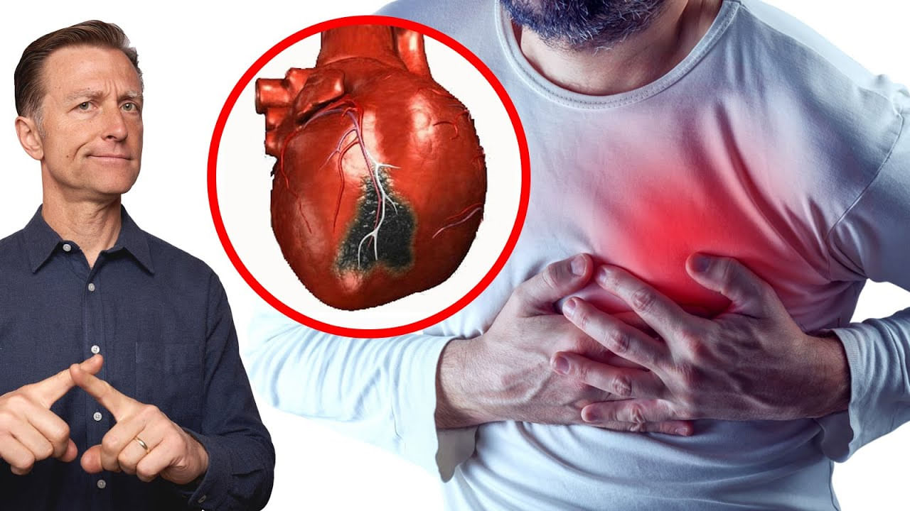 Heart Attack: ఇవే ఆకస్మిక గుండె పోటుకు ప్రధాన కారణాలా..? హార్ట్ ఎటాక్స్ విషయంలో నిపుణులు ఏమంటున్నారంటే..?