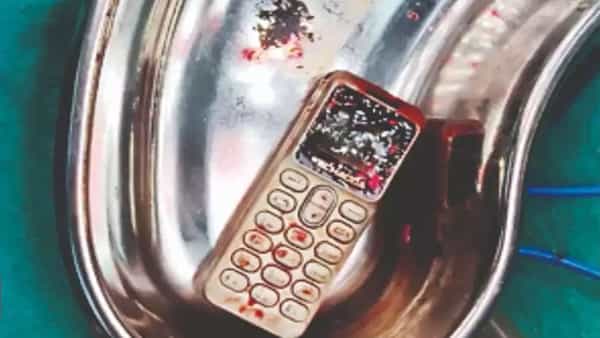 Girl Swallows Mobile: సోదరుడితో గొడవపడి సెల్ఫోన్ మింగేసిన యువతి.. ఆ తర్వాత ఏమైందంటే..?