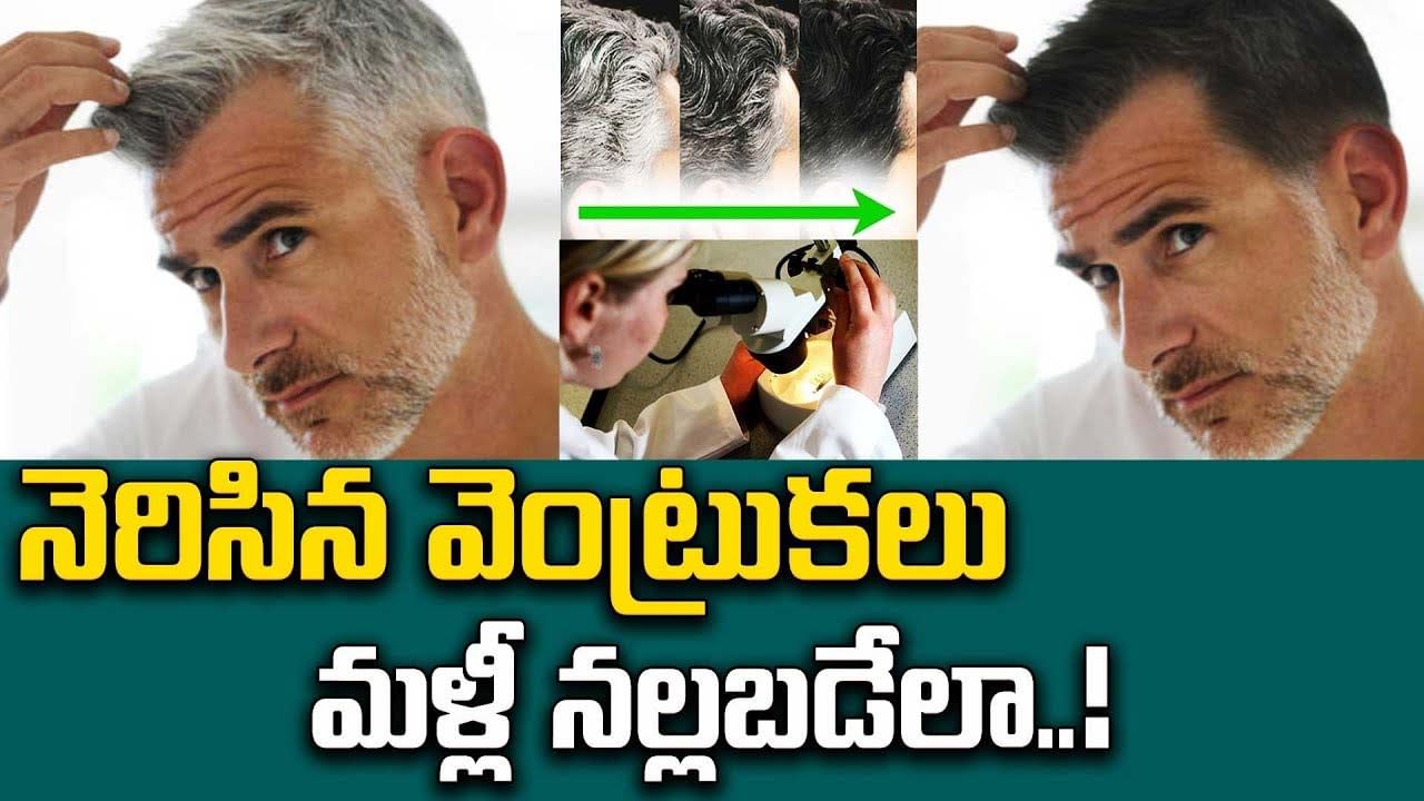 Grey Hair: నెరిసిన వెంట్రుకలు మళ్లీ  నల్లబడేలా..