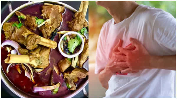 High Cholesterol: కొలెస్ట్రాల్ ఉన్నట్లు నిర్ధారణ అయిన తర్వాత కూడా మటన్ తింటున్నారా? అయితే జాగ్రత్త..!
