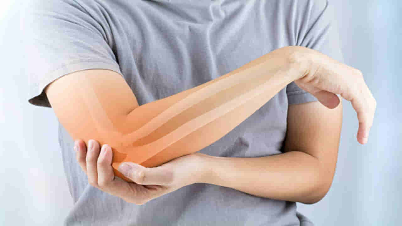Rheumatoid Arthritis: ఆర్థరైటిస్ వ్యాధితో బాధపడుతున్నారా..? మీ లైఫ్ లో ఈ మార్పులు చేస్తే..