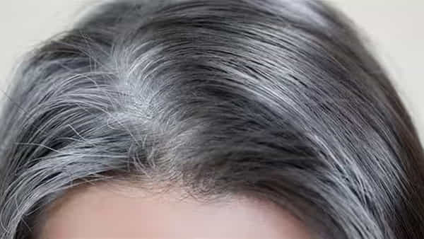 White Hair: తెల్లజుట్టుకు అసలు కారణాలివే..! తేల్చి చెబుతున్న ‘న్యూయార్క్’ అధ్యయనాలు..