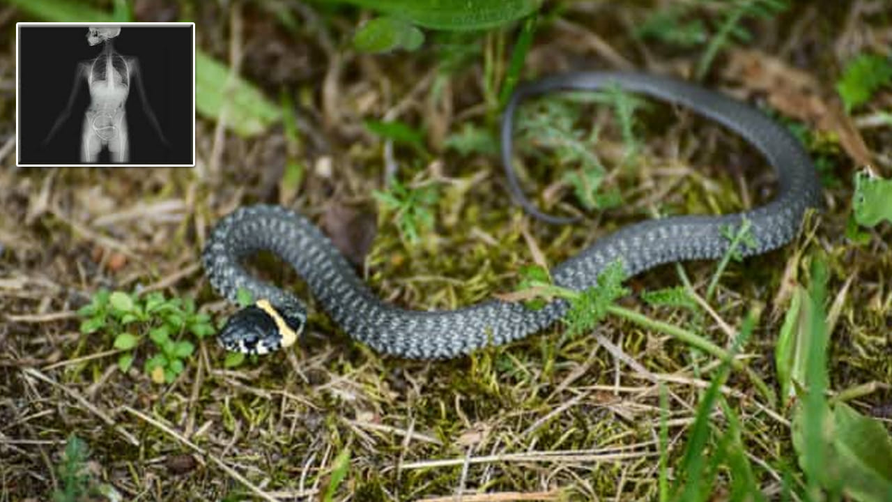 Viral: మల విసర్జన చేస్తుండగా శరీరంలోకి దూరిన పాము! లబోదిబోమంటూ ఆస్పత్రికి పరుగులు.. కట్ చేస్తే బిగ్ ట్విస్ట్..