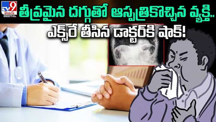 తీవ్రమైన దగ్గుతో అస్పత్రికొచ్చిన వ్యక్తి.. ఎక్స్రే తీసిన డాక్టర్కి షాక్ !! తీవ్రమైన దగ్గుతో అస్పత్రికొచ్చిన వ్యక్తి.. ఎక్స్రే తీసిన డాక్టర్కి షాక్ !!