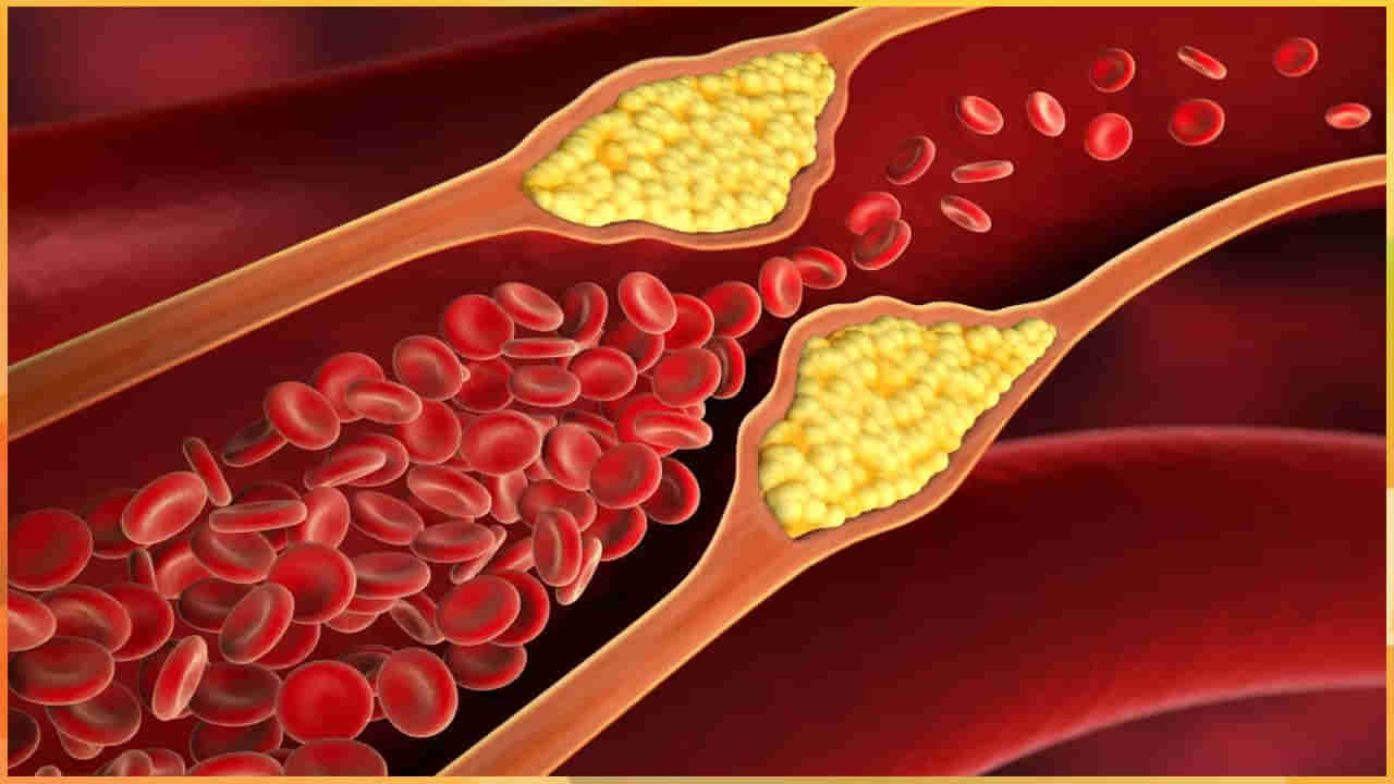 Cholesterol: కొలెస్ట్రాల్‌ను తగ్గించడంలో సహాయపడే 5 ఆహారాలు