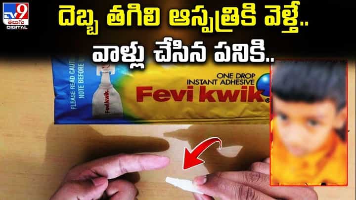 వామ్మో.. ఇదెక్కడి వైద్యం.. దెబ్బ తగిలి ఆస్పత్రికి వెళ్తే.. డాక్టర్ చేసిన వింత పనికి అంతా షాక్ వామ్మో.. ఇదెక్కడి వైద్యం.. దెబ్బ తగిలి ఆస్పత్రికి వెళ్తే.. డాక్టర్ చేసిన వింత పనికి అంతా షాక్