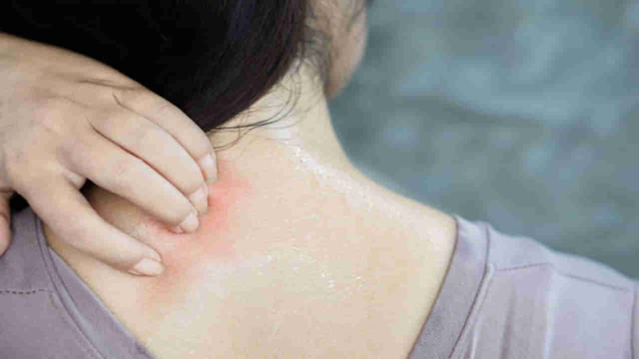 Skin Care: వేసవిలో చర్మం కాంతి వంతంగా.. డీటాక్స్ కావాలంటే.. అద్భుతమైన ఆయుర్వేద చిట్కాలు మీకోసం..