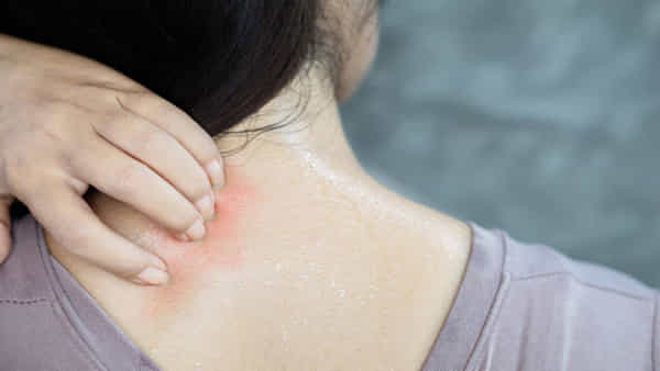Skin Care: వేసవిలో చర్మం కాంతి వంతంగా.. డీటాక్స్ కావాలంటే.. అద్భుతమైన ఆయుర్వేద చిట్కాలు మీకోసం..