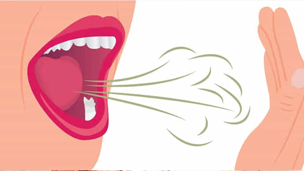 Mouth Fresh Tips: నోటి దుర్వాసన వేధిస్తోందా? ఈ 5 అలవాట్లో చెక్ పెట్టండి..