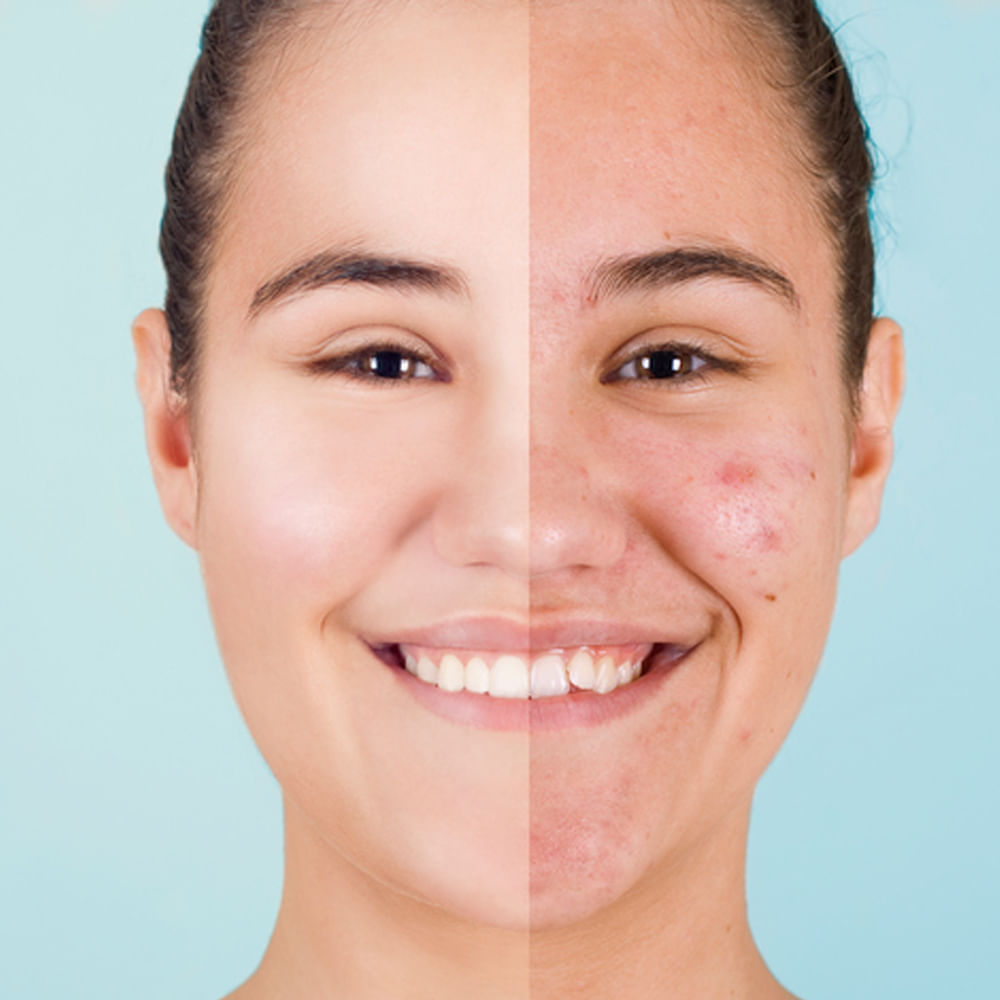 ప్రస్తుత జీవనశైలి కారణంగా ఎన్నో ఆరోగ్య సమస్యలు వస్తున్నాయి. అలాగే ఎన్నో చర్మ సమస్యలు కూడా వస్తున్నాయి. మొఖంపై మొటిమలు, చర్మం పొడిబారడం, ముడతలు వంటి ఎన్నో సమస్యలు వస్తున్నాయి. ఈ సమస్యల నుంచి బయటపడాలంటే ఆరోగ్యమైన ఆహారమే తీసుకొవడంతో పాటు ఫేస్ ప్యాక్స్ కూడా ఉపయోగించాలి. మీ చర్మ సౌందర్యాన్ని కాపాడే ఫేస్ ప్యాక్స్ ఏంటో ఇప్పుడు తెలుసుకుందాం.