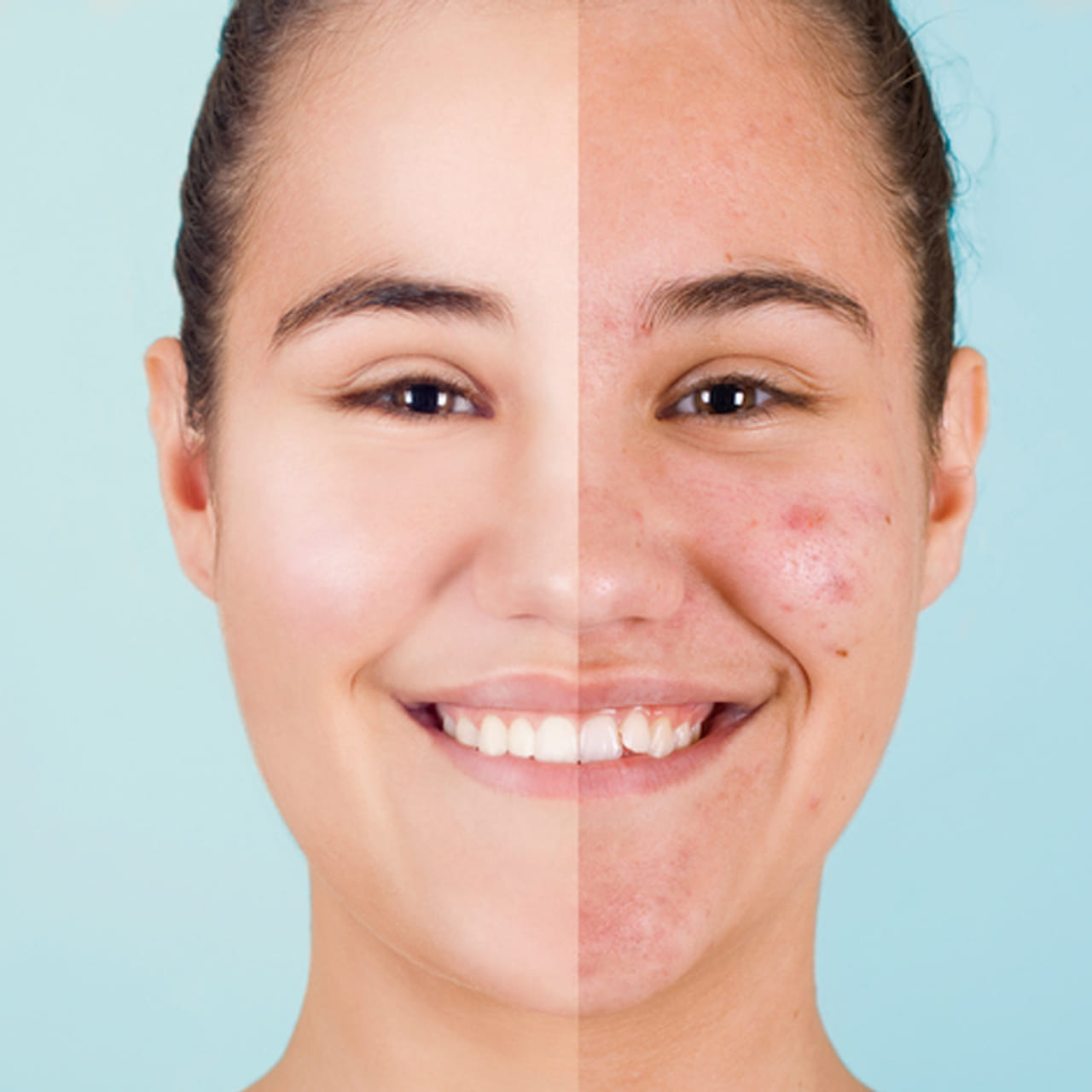 ప్రస్తుత జీవనశైలి కారణంగా ఎన్నో ఆరోగ్య సమస్యలు వస్తున్నాయి. అలాగే ఎన్నో చర్మ సమస్యలు కూడా వస్తున్నాయి. మొఖంపై మొటిమలు, చర్మం పొడిబారడం, ముడతలు వంటి ఎన్నో సమస్యలు వస్తున్నాయి. ఈ సమస్యల నుంచి బయటపడాలంటే ఆరోగ్యమైన ఆహారమే తీసుకొవడంతో పాటు ఫేస్ ప్యాక్స్ కూడా ఉపయోగించాలి. మీ చర్మ సౌందర్యాన్ని కాపాడే ఫేస్ ప్యాక్స్ ఏంటో ఇప్పుడు తెలుసుకుందాం.