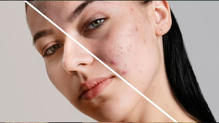 Health: మీ శరీరంలో ఈ లక్షణాలు కనిపిస్తున్నాయా? అయితే అది తగ్గించాల్సిందే.. ముప్పు తప్పదు..!