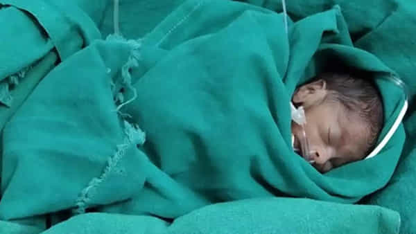 Premature Babies: భారత దేశంలో నెలల నిండకుండానే పుడుతున్న పిల్లలు అధికం.. ఐదేళ్ల లోపు శిశు మరణాలు ఎక్కువే అంటున్న