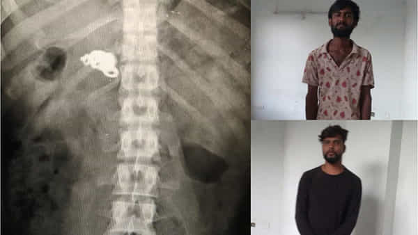 అయ్యయ్యో.. ఈ దొంగకొచ్చిన కష్టం మరెవ్వరికీరాకూడదు.. కాపాడండంటూ పోలీసుల ఎదుట గగ్గోలు