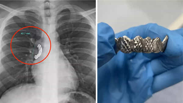 Viral: ఉన్నట్టుండి కళ్లు తిరిగి పడిపోయిన వ్యక్తి.. ఆస్పత్రికెళ్లగా.. ఎక్స్రేలో షాకింగ్ నిజం!