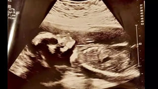 Viral: తీరానికి కొట్టుకొచ్చిన వింత చేప.. బరువు ఎంతో తెలిస్తే షాకే.!