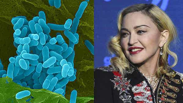 Madonna Health: ప్రాణాంతక వైరస్ బారిన పడిన పాప్ సింగర్ మడోన్నా.. క్షణాల్లో ప్రాణాలు తీసే ఈ బ్యాక్టీరీయా ఎలా సోకుతుంది లక్షణాలు ఏమిటంటే?