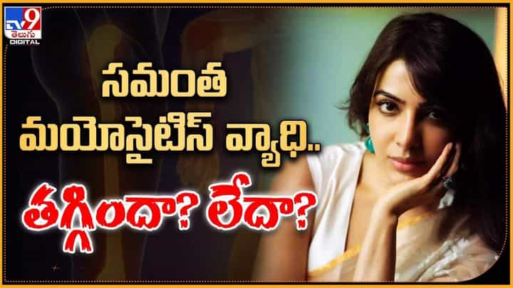 Samantha: సమంత మయోసైటిస్ వ్యాధి.. తగ్గిందా? లేదా? Samantha: సమంత మయోసైటిస్ వ్యాధి.. తగ్గిందా? లేదా?