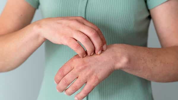 Fungal Infections: వర్షాకాలం జరభద్రం! చర్మ వ్యాధులూ ప్రబలుతాయ్.. ఈ టిప్స్ పాటిస్తే మీరు సేఫ్..