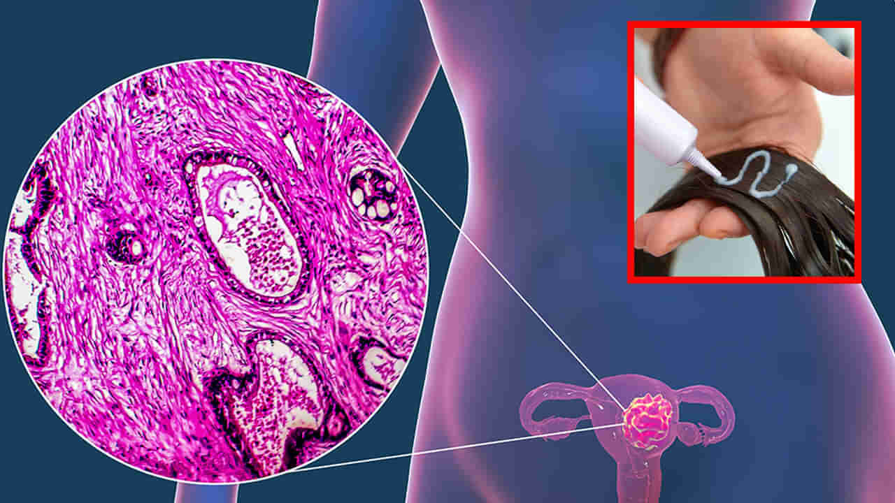 Uterine Cancer: ఆ క్రీమ్‌లతో గర్భాశయ క్యాన్సర్..? తాజా అధ్యయనంలో విస్తుపోయే వివరాలు..