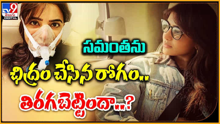 Samantha: సమంత ను ఛిద్రం చేసిన రోగం మళ్లీ తిరిగబెట్టిందా..? సామ్ కు ఏమైంది.? Samantha: సమంత ను ఛిద్రం చేసిన రోగం మళ్లీ తిరిగబెట్టిందా..? సామ్ కు ఏమైంది.?